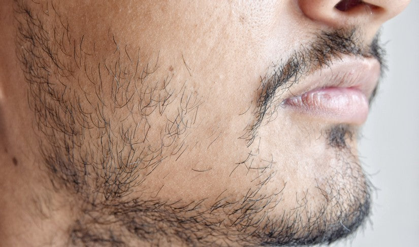 Stryx How To Fix A Patchy Beard 5 Proven Ways